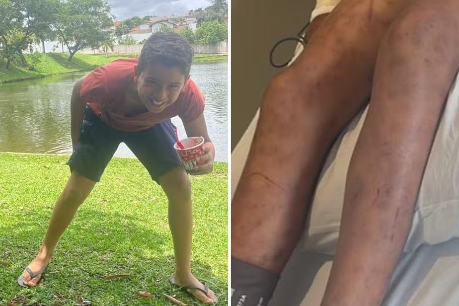 Menino de 9 anos morre após ser picado diversas vezes por abelhas em Catalão  | CBN-GO